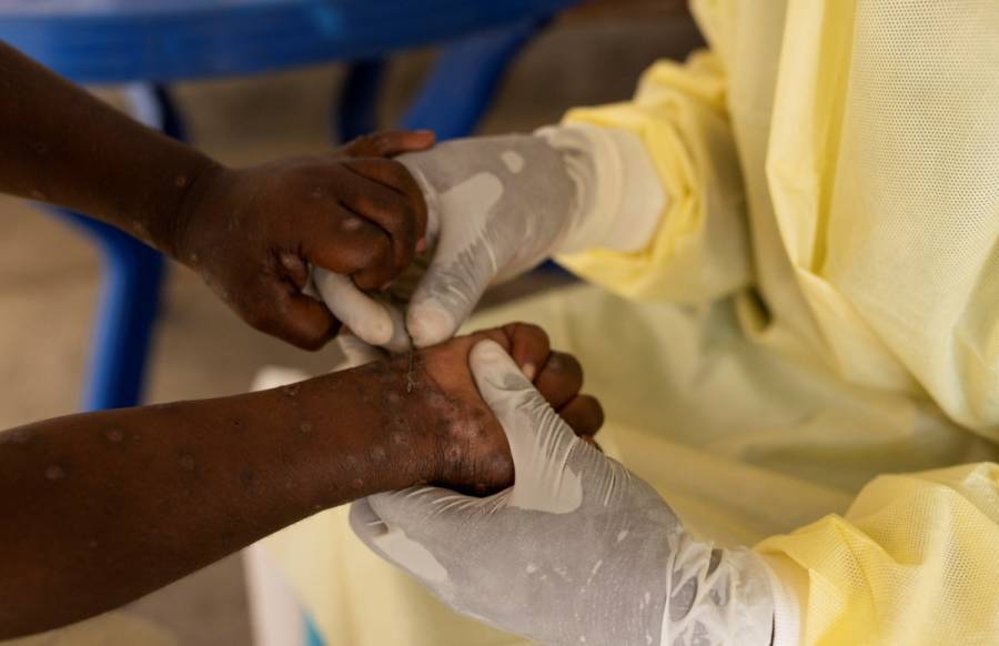 La OMS declara al mpox como nueva emergencia de salud pública internacional
