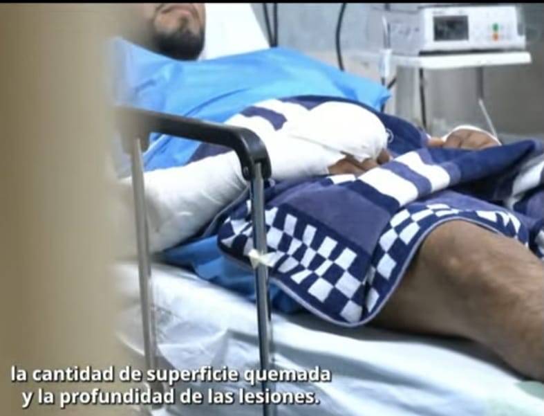 41 personas con quemaduras por explosi&oacute;n de pipa en Iztapalapa recibieron atenci&oacute;n en el Rub&eacute;n Le&ntilde;ero; tres siguen internas