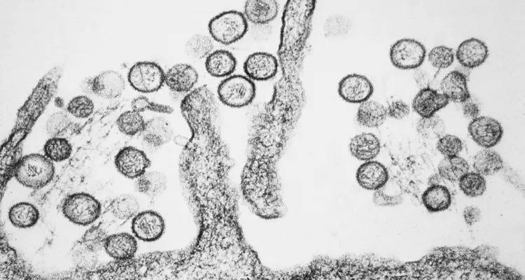 Chile reporta aumento de casos de hantavirus en 2026; variante Andes predomina en el pa&iacute;s